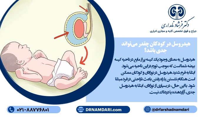 هیدروسل در کودکان چقدر می‌تواند جدی باشد؟