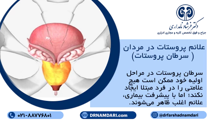 علائم پروستات در مردان ( سرطان پروستات)