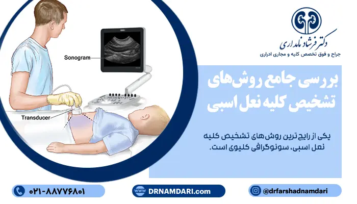 بررسی جامع روش‌های تشخیص کلیه نعل اسبی