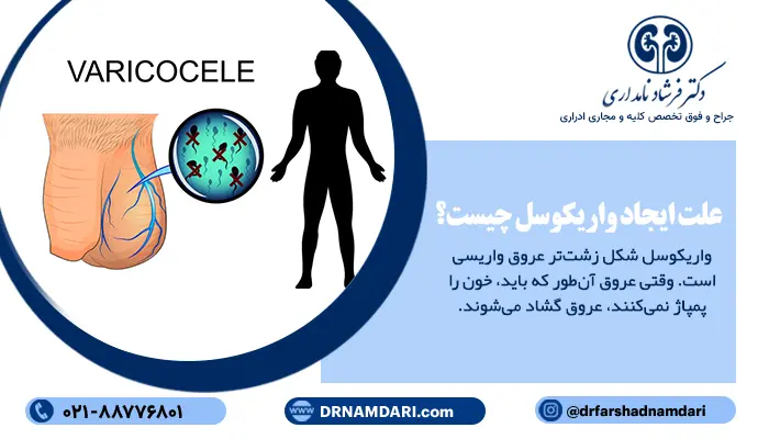 علت ایجاد واریکوسل چیست؟