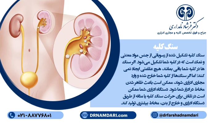 سنگ کلیه می تواند دلیل وجود موکوس در ادرار باشد