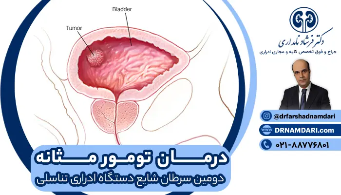 تومور مثانه + کارسینوم اوروتلیال پاپیلاری درجه پایین