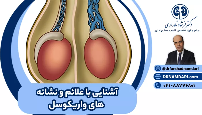علائم واریکوسل