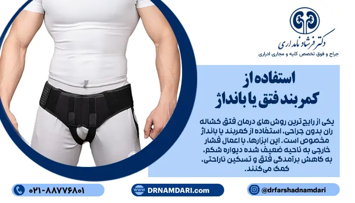 یکی از رایجترین روشهای درمان فتق کشاله ران بدون جراحی، استفاده از کمربند یا بانداژ مخصوص است.
