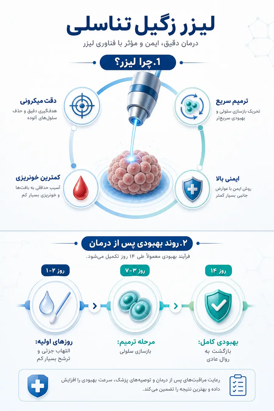 تصویر اینفوگرافیک لیزر زگیل تناسلی