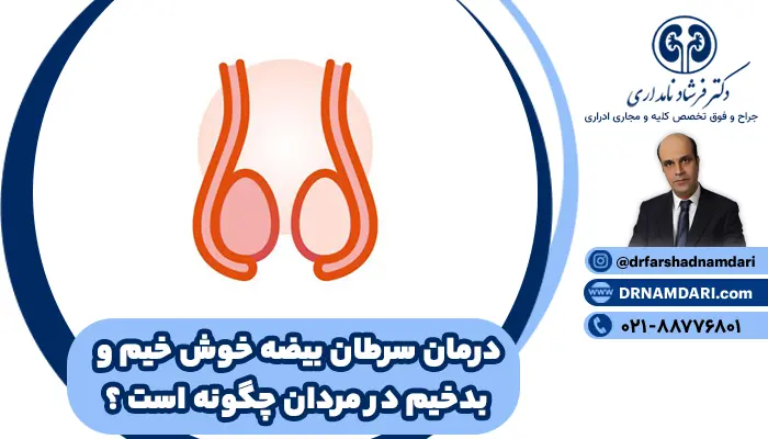 بررسی مراحل سرطان: از ایجاد تومورهای خوش خیم بیضه تا پیشرفت سرطان بیضه بدخیم