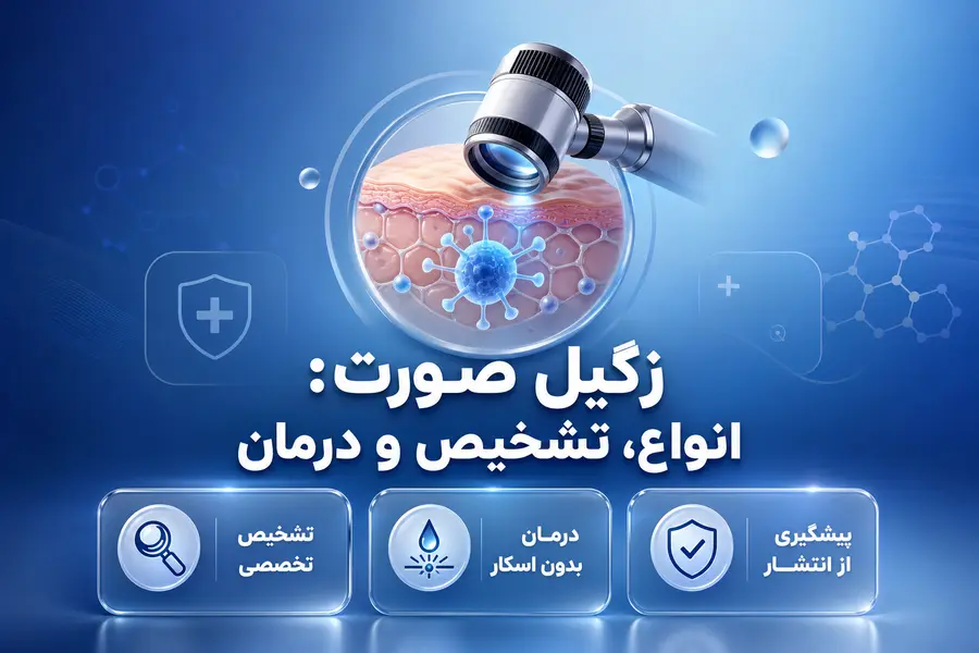 زگیل صورت چیست؟ درمان زگیل صورت و آشنایی با انواع زگیل صورت