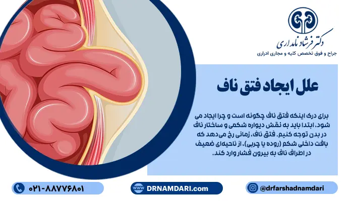 برای درک اینکه فتق ناف چگونه است و چرا ایجاد میشود، ابتدا باید به نقش دیواره شکمی و ساختار ناف در بدن توجه کنیم. فتق ناف، زمانی رخ میدهد که بافت داخلی شکم (روده یا چربی)، از ناحیهای ضعیف در اطراف ناف به بیرون فشار وارد کند. این ضعف، میتواند مادرزادی باشد یا به دلایل خاصی در دوران بزرگسالی، ایجاد شود.
