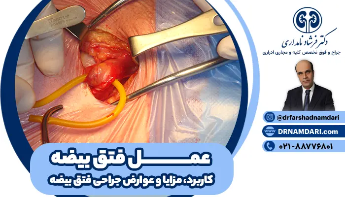 عمل فتق بیضه، به عنوان روش استاندارد درمان این مشکل، با بازگرداندن بافت بیرونزده به محل اصلی و تقویت ناحیه آسیبدیده، انجام میشود.