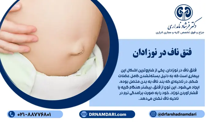 فتق ناف در نوزادان، یکی از شایعترین اشکال این بیماری است که به دلیل بستهنشدن کامل عضلات شکم، در ناحیهای که بند ناف به بدن متصل بوده، ایجاد میشود. این نوع از فتق، بیشتر هنگام گریه یا فشار آوردن نوزاد، خود را به صورت برآمدگی نرم در ناحیه ناف نشان میدهد.
