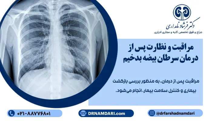 مراقبت و نظارت پس از درمان سرطان بیضه بدخیم