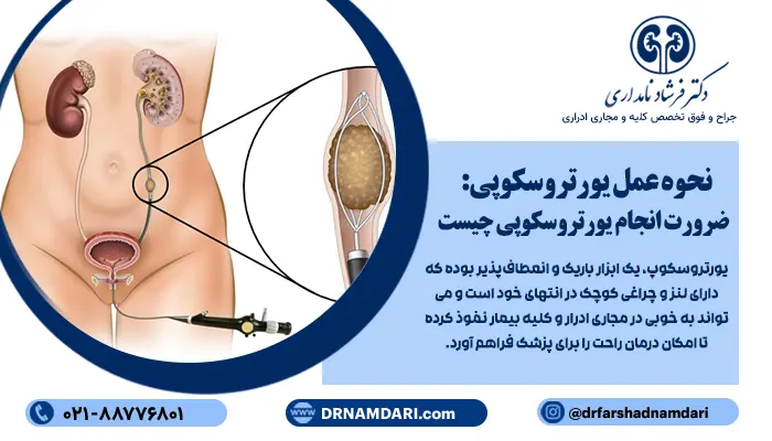 نحوه عمل یورتروسکوپی: ضرورت انجام یورتروسکوپی چیست